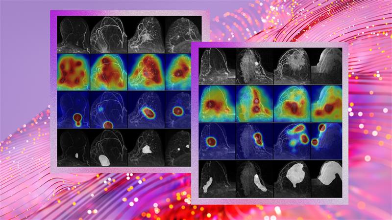 Microsoft’s AI-Powered Approach to Breast Cancer Screening Aims to Deliver Accuracy, Clarity, and Trust